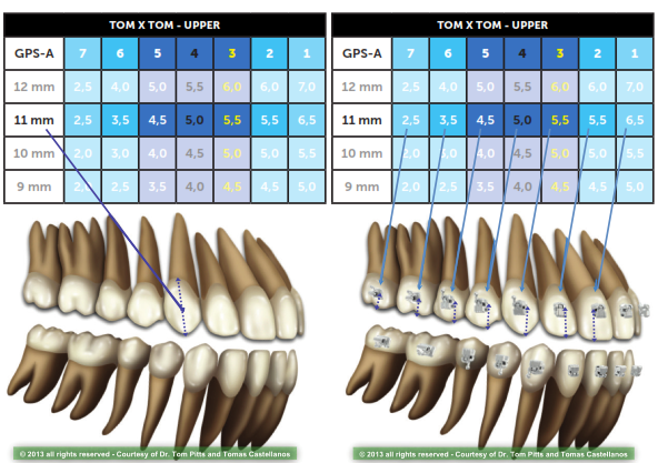 Второй этап