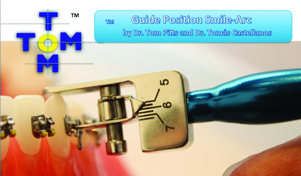 Guide Position Smile