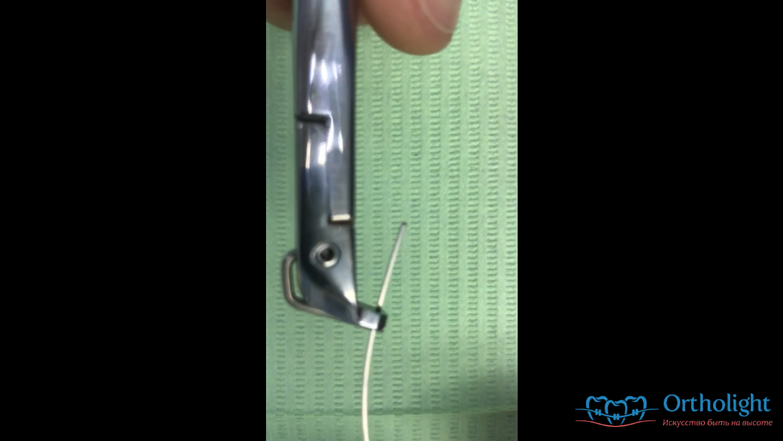 Как правильно откусывать дугу дистальными кусачками