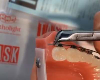 Обзор на дистальные кусачки с безопасным удержанием дуги 30-551US