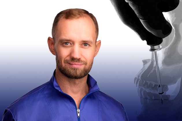 Применение минивинтов в ежедневной клинической практике врача ортодонта