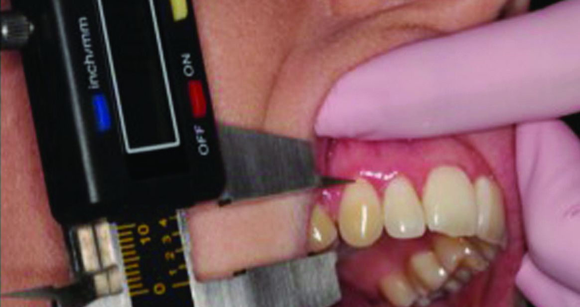 Снятие размеров