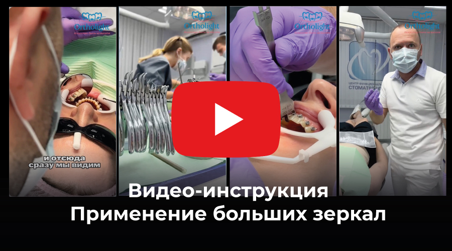 Как использовать крупные зеркала на приеме ортдонта