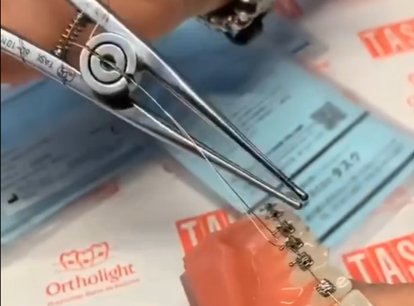 Обзор на щипцы Куна 61011 (60-101C)