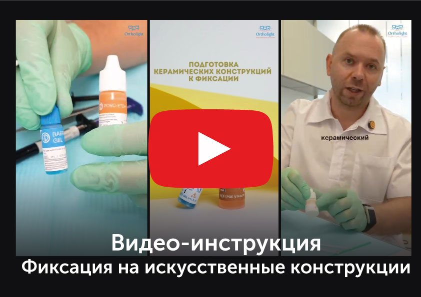 Фиксация на искусственные конструкции