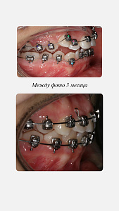 Чеминава Ирина
