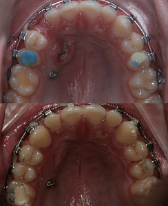 Тохтиева Дана