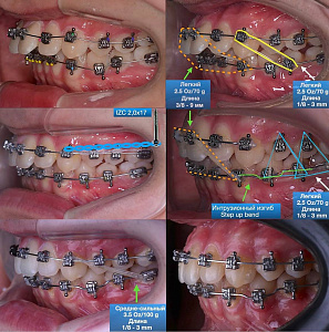 Бабатов Ислам