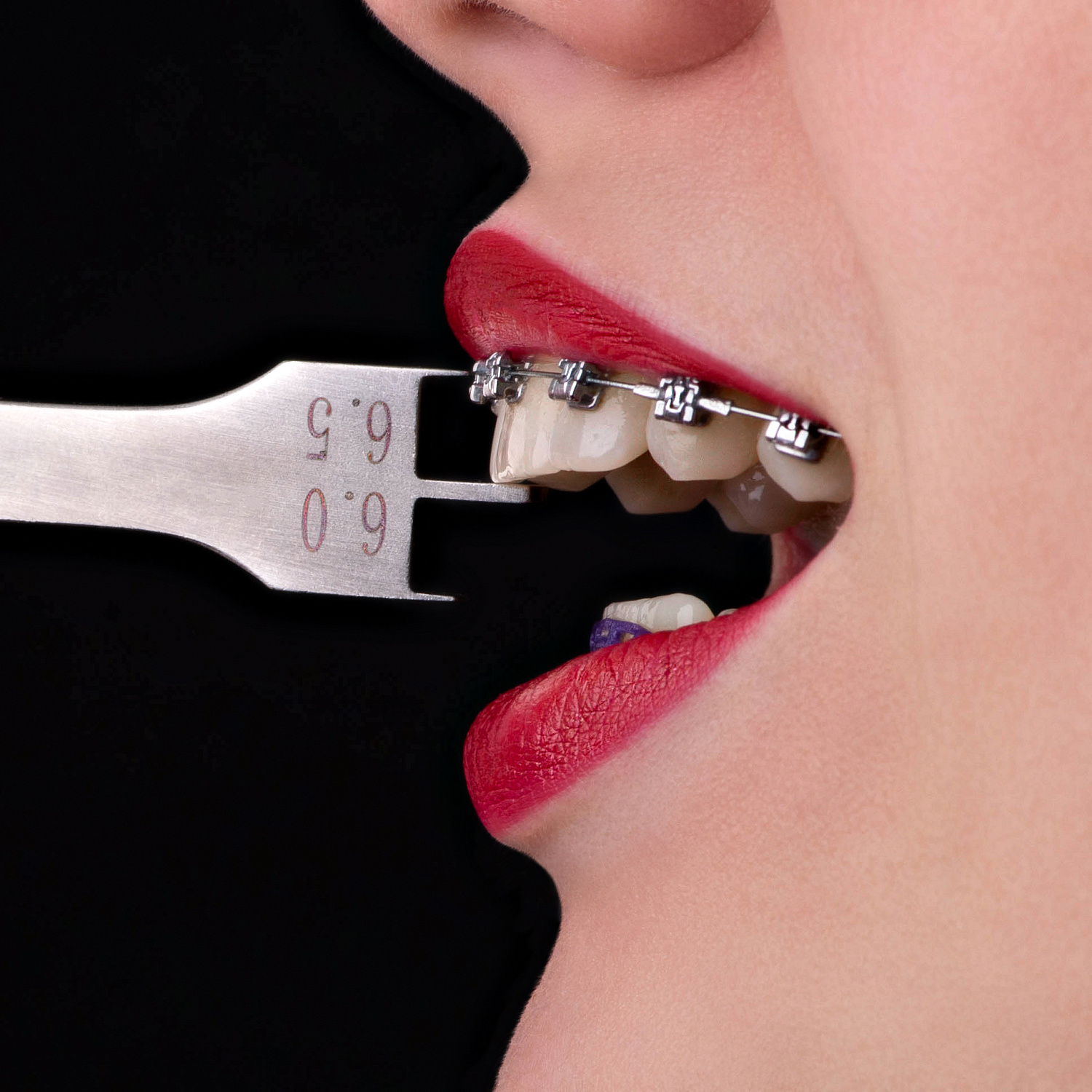 Позиционер ортодонтический высокий 7.5-9.0 Позиционер ортодонтический высокий 7.5-9.0