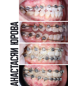 Анастасия Юрова