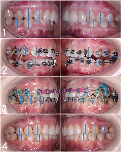 Бухарова Елена