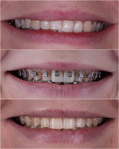 Бухарова Елена