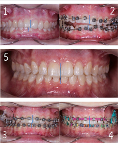 Бухарова Елена