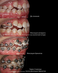 Чеминава Ирина