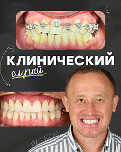 Хасанова Диана Романовна (@dianadi1881)