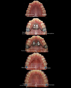 Чеминава Ирина