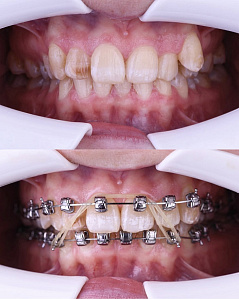 Осман Хозан