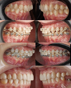 Эльдерхан (Ахмад) Зоргиевич