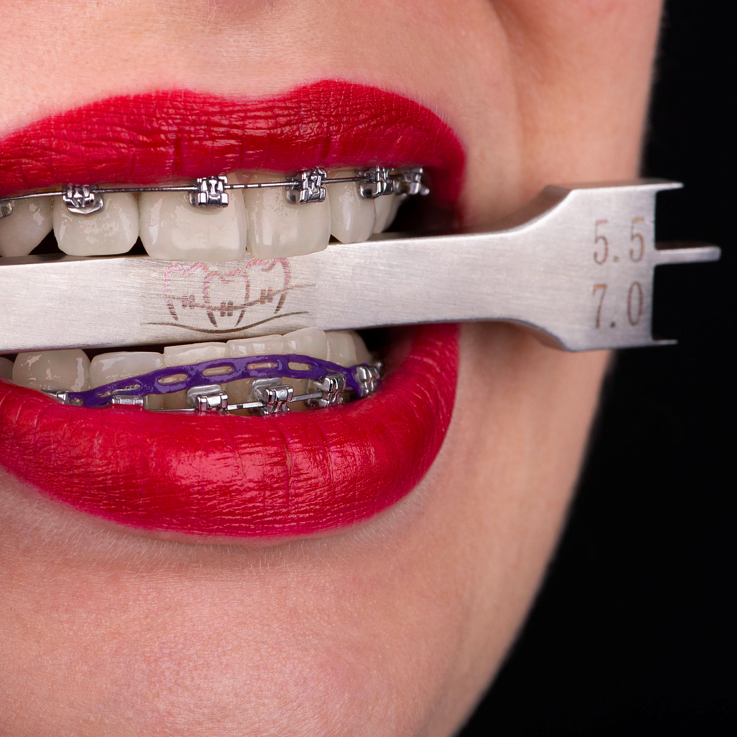 Позиционер ортодонтический высокий 7.5-9.0 Позиционер ортодонтический высокий 7.5-9.0