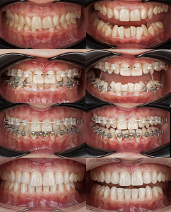 Эльдерхан (Ахмад) Зоргиевич