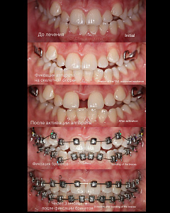 Чеминава Ирина