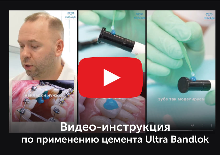Инструкция по применению цемента Ultra Bandlok для врачей-ортодонтов.